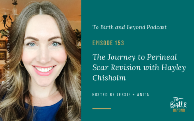 Episode 153: The Journey to Perineal Scar Revision with Hayley Chisholm