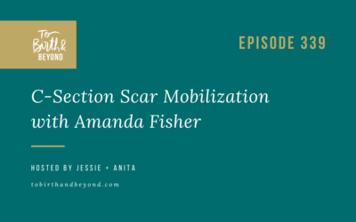 Episode 339: C-Section Scar Mobilization with Amanda Fisher